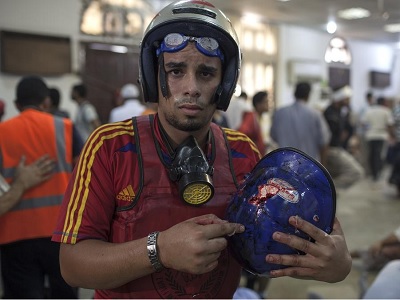 Anti-coup demonstrator holds the helmet of a protestor shot dead by police (a bullet hole and brain tissue was visible on the helmet) as he stands inside a packed field hospital. (Photo: Scott Nelson/Al Jazeera)
